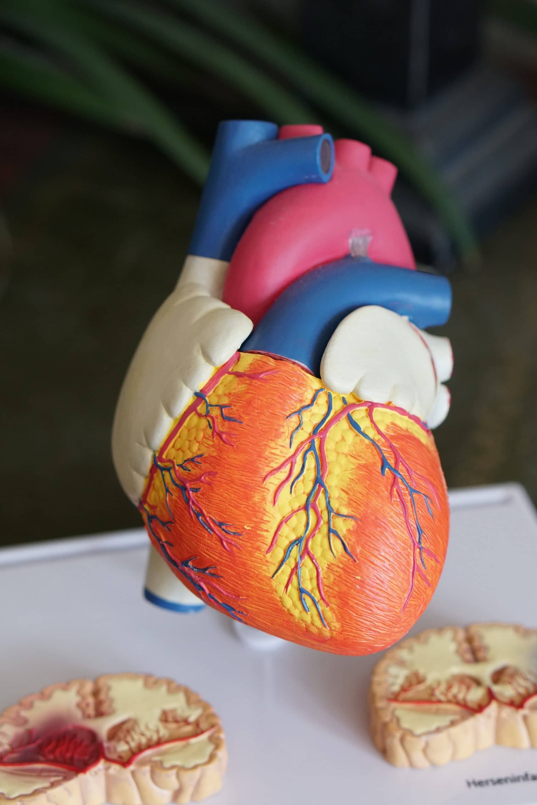 model of heart